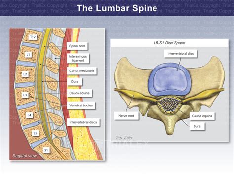 The Lumbar Spine Trial Exhibits Inc