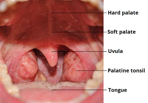 Examination Of The Oral Cavity Teachmesurgery