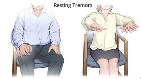 Parkinsons Tremor Causes Treatments And More Page Entirely Health