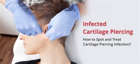 Infected Cartilage Piercing 6 Causes Treatments And Prevention Tips