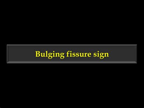 Figure 3 Sign Fleischner Sign Fissure Sign Headcheese Sign Hilar