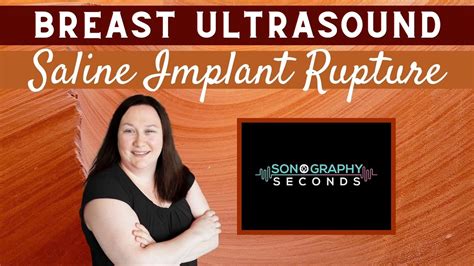 Breast Ultrasound Saline Intracapsular And Extracapsular Implant Rupture