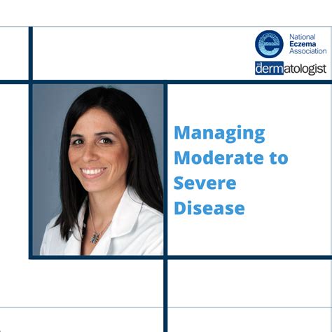 Managing Moderate To Severe Disease