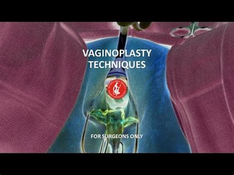Vaginoplasty Vaginal Rejuvenation Surgery With Manual Robotic Arms