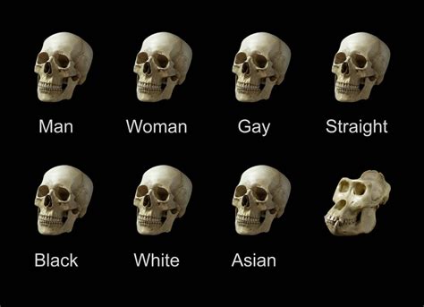 Made Very Hd Skull Meme With Dark Theme Invest Now Before It Loses All