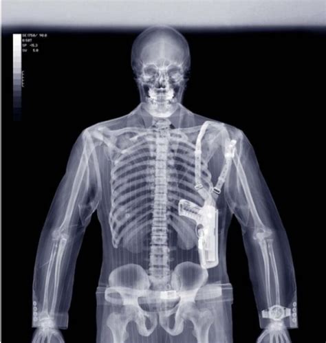 Curious Funny Photos Pictures 14 Excellent Xray Pictures