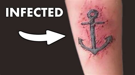 Aggregate More Than 74 Signs Of An Infected Tattoo Super Hot Edo