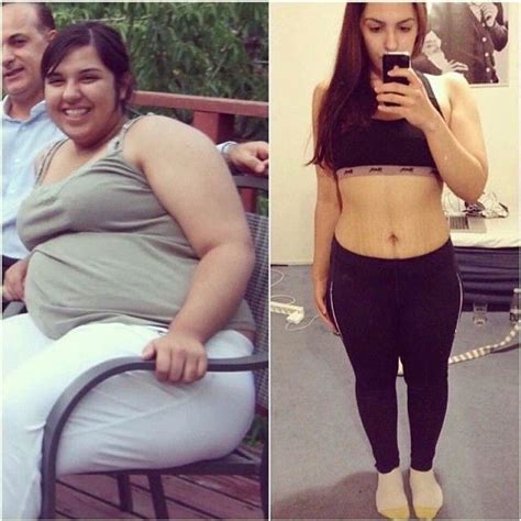 Some Weight Loss Transformations You Look At And You Can’t Believe Them Some Shock You Some