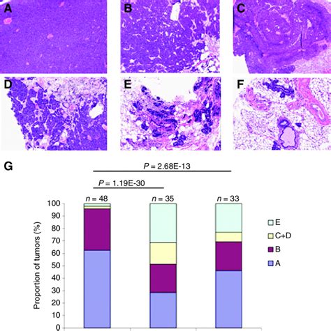 Analysis Of Histologic Types Of Mammary Tumors Observed In Control And