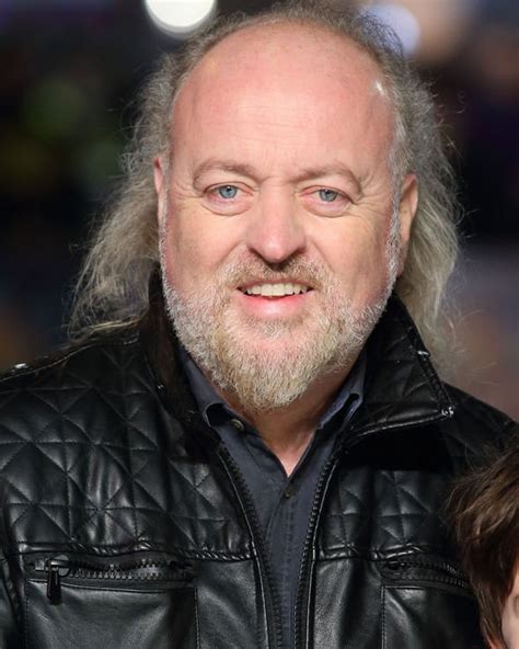 Bill Bailey Health Comedians Hair Loss ‘likely Caused By Male Pattern