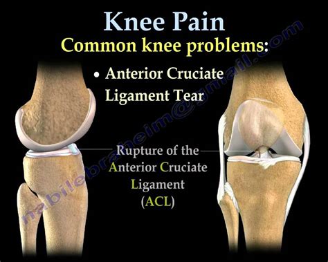 Common Knee Problems Minimalis