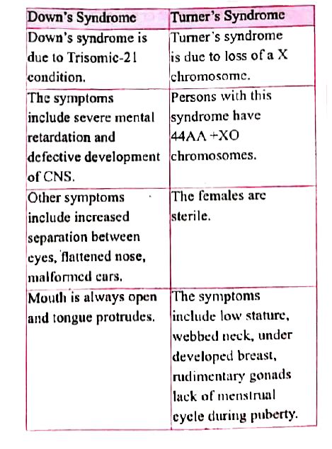 Tamil Solution Differenciate Downs Syndrome From Turners Synd