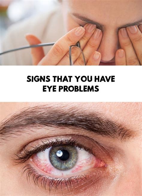 Signs That You Have Eye Problems Eyes Problems Dry Eye Syndrome