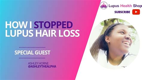 Lupus Hair Loss Treatment Lupus Health Shop Lupus Life Hacks Youtube