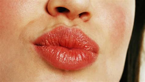 What Causes Dark Spots On Lips Dessert Laboc
