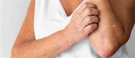 Itching Sans Rash Causes And Treatment