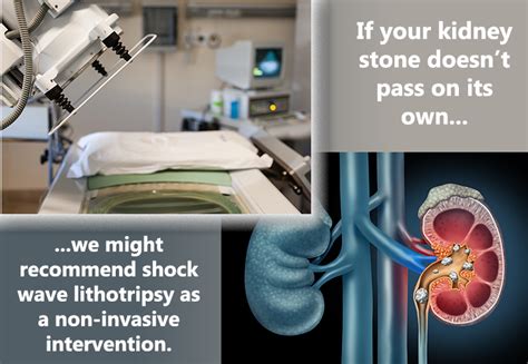 Kidney Stones Manchester Urology Associates Pa