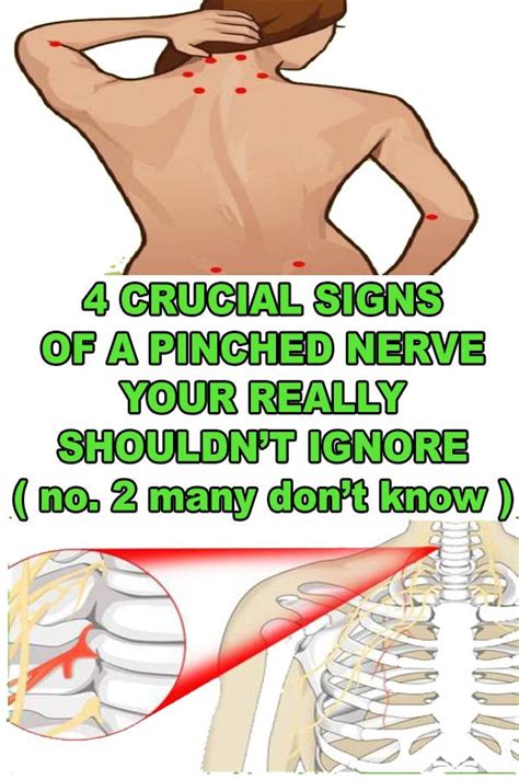 4 Crucial Signs Of A Pinched Nerve You Really Shouldt Ignore Pinched