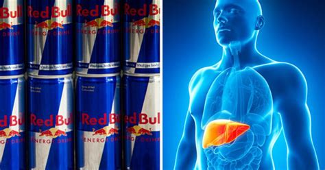 What Red Bull Does To Your Liver Will Shock You Daily Star