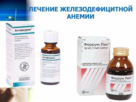 Диета при железодефицитная анемия Железодефицитная анемия - презентация онлайн Железодефицитная анемия - презентация онлайн Диета при железодефицитная анемия