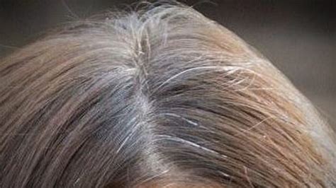 Despite having purple pigments that help cancel out the brassiness in your hair, this shampoo lathers white. Home Remedies to Stop Gray Hair