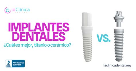 Implantes Dentales Cu L Es Mejor Titanio O Cer Mico La Cl Nica