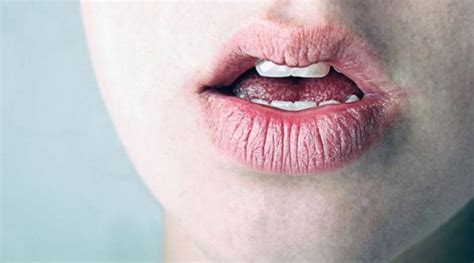 Сухость во рту и жжение языка причины и подходы к лечению неприятного ощущения