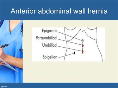 Abdominal Wall Hernia