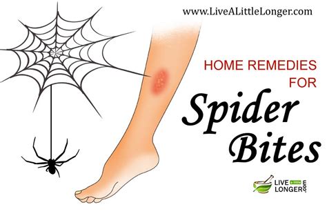 Black Widow Spider Bite Treatment Black Widow Bite Beginning Stages