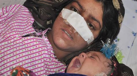 Afghan Womans Nose Cut Off By Husband Cnn