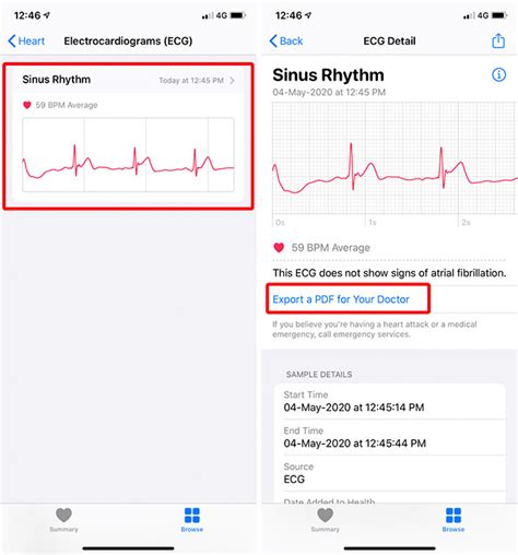 How To Use Apple Watch Ecg Feature Effectively Beebom