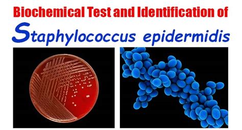 Staphylococcus Saprophyticus Colony Morphology