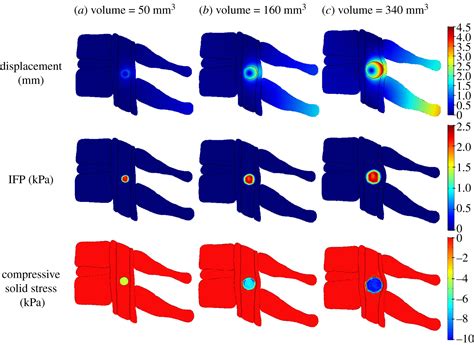 Biomechanical Modelling Of Spinal Tumour Anisotropic Growth