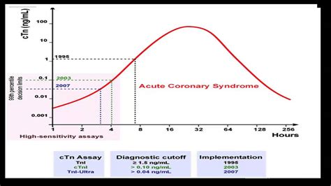 The normal pulse for healthy adults ranges from 60 to 100 beats per minute. Troponin - YouTube