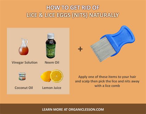 Quick Way To Get Rid Of Nits Just For Guide