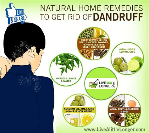 Here Are Some Remedies For Dandruff Getting Rid Of Dandruff Dandruff