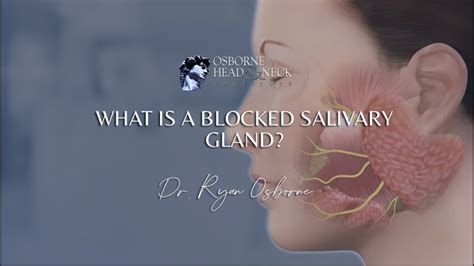 What Is A Blocked Salivary Gland Youtube