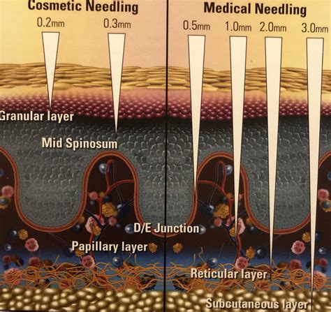 How Deep Should You Be Microneedling Demystifying Skincare With Science