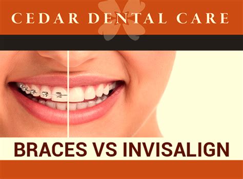 Martinez is fluent in spanish and thankful of having the opportunity of improving many people's quality of life through dentistry. Know the best #technology for #teeth alignment. Read here ...