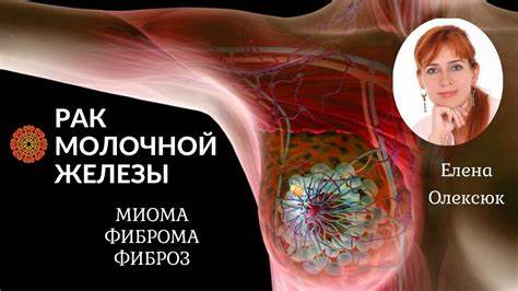 Какая диета при раке груди