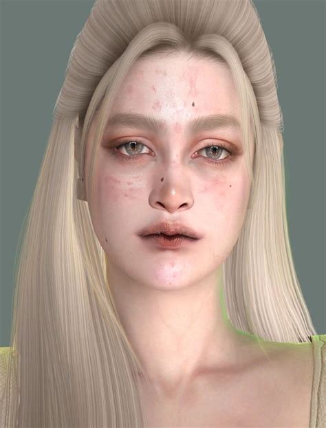 Pimple Scars Pimples On Face Face Acne Acne Skin Sims 4 Body Mods