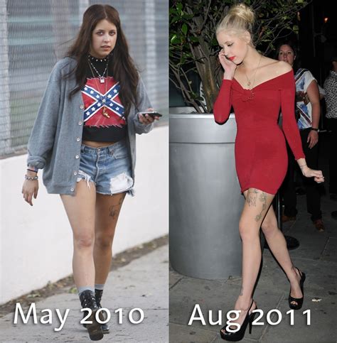 Was Peaches Geldof In The Grips Of Anorexia