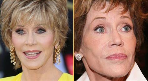 Jane Fonda Before And After Plastic Surgery Celebrity Plastic Surgery