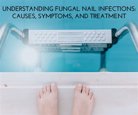 Fungal Nail Infection Overview Causes Treatments Hot Sex Picture
