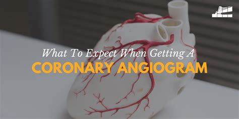 What To Expect When Getting A Coronary Angiogram — Bay Imaging Consultants