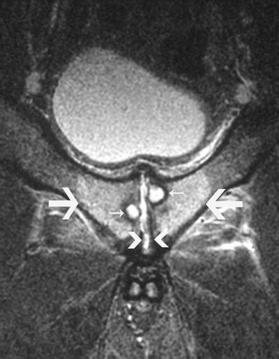 Diagnosis Of A Lump In The Groin In The Adult Springerlink
