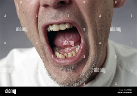 Screaming Man Mouth Open Yelling Stock Photo Alamy