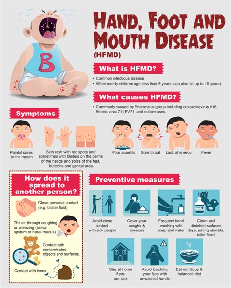 Buka Minda Handfood And Mouth Disease