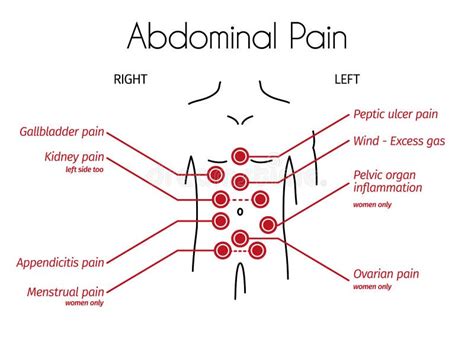 Vector Infographic Of Abdominal Pain Types Stock Vector Illustration