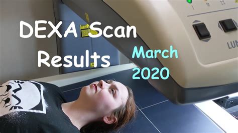 Dexa Scan Results March 2020 Youtube